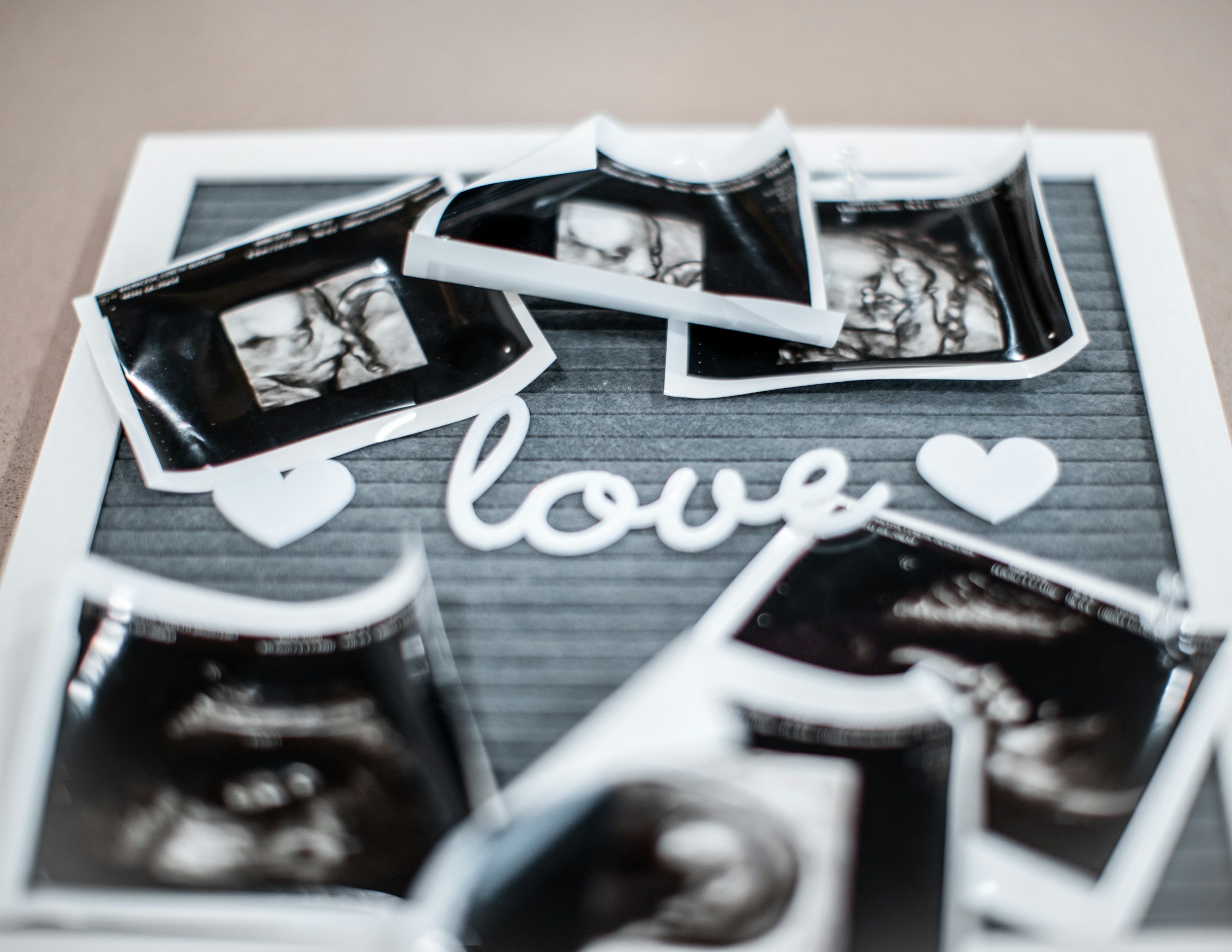 Ultrasound scan during pregnancy